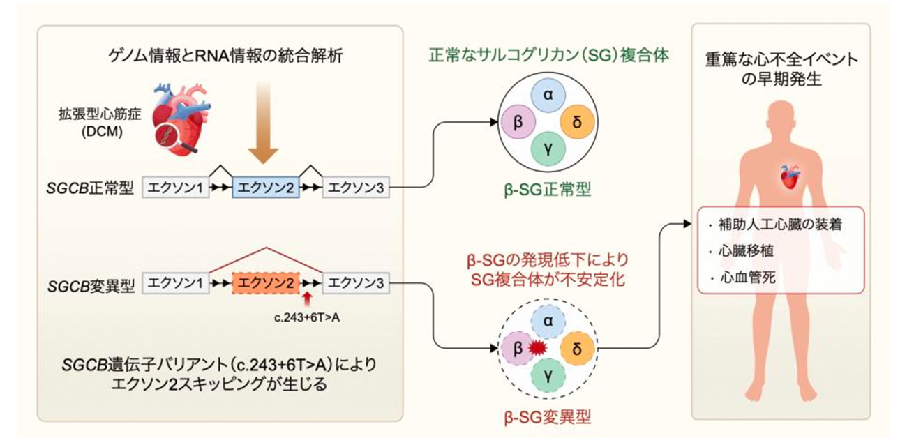 筋ジストロフィー関連遺伝子SGCBが重症拡張型心筋症の原因でもあることを発見