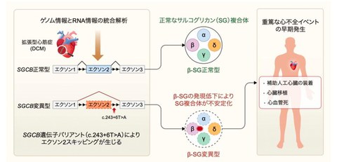 低電位領域アブレーション”の有効性を検証 - ResOU