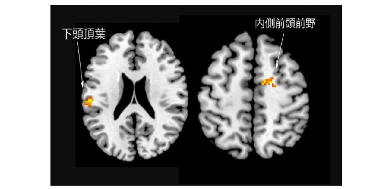 \“敵対関係”が人物相関図の要/ ドラマ視聴で形成される人間関係の脳内表象を解明