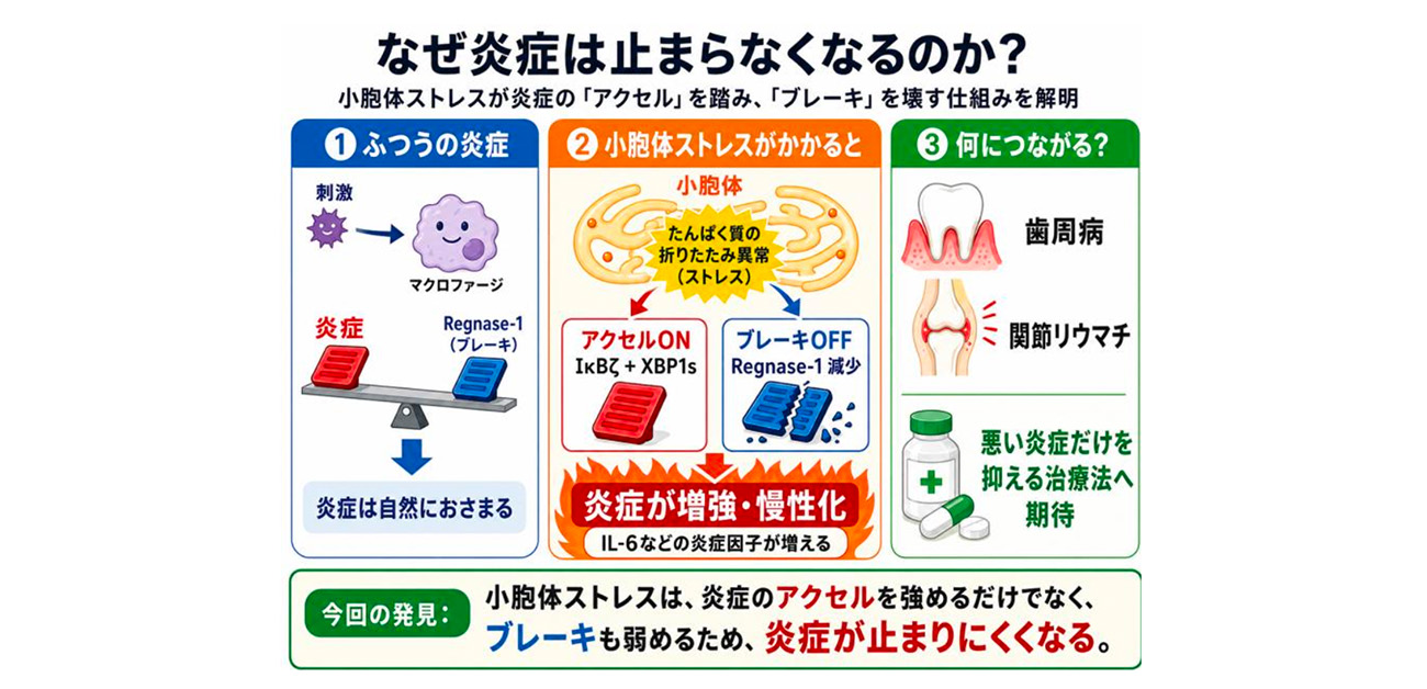炎症はなぜ止まらなくなるのか？その「暴走スイッチ」を解明