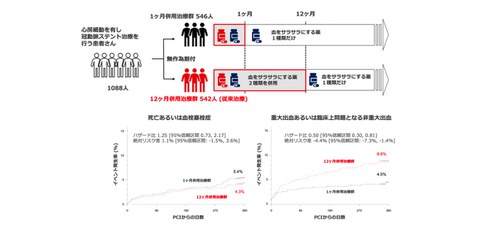 低電位領域アブレーション”の有効性を検証 - ResOU