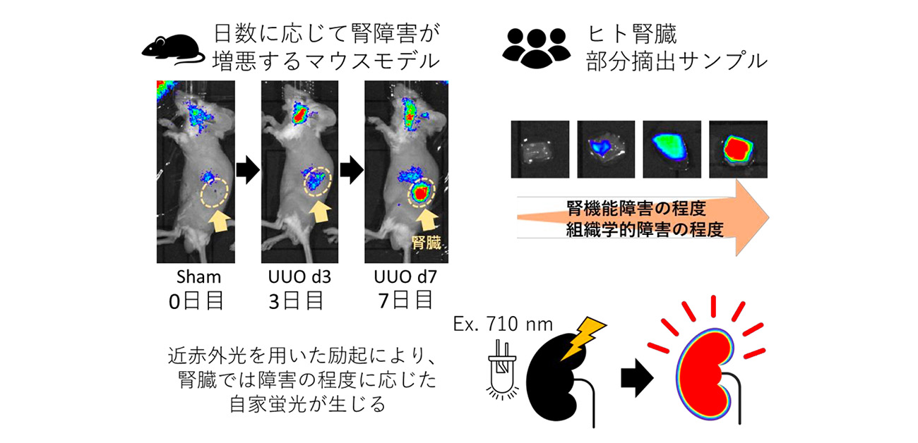 \傷んだ腎臓が光る!/ 光による腎障害の非侵襲的イメージング方法を確立