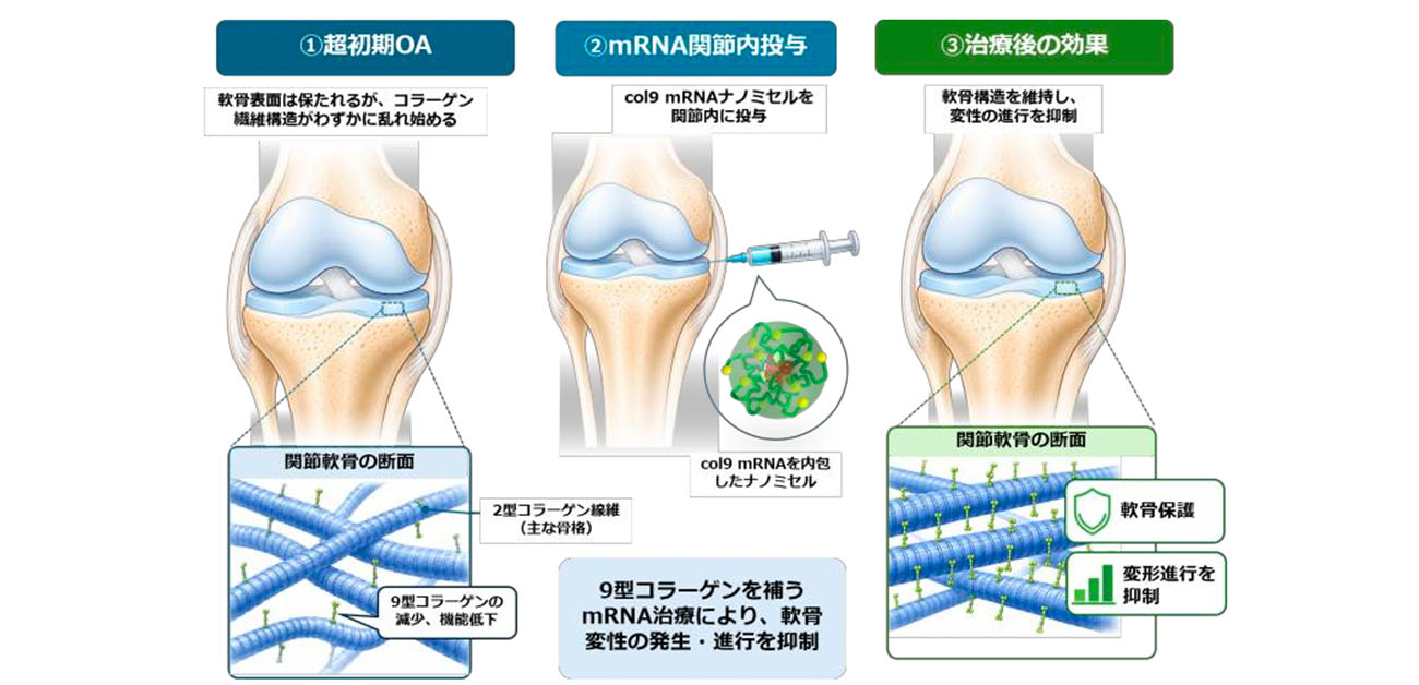 \mRNA創薬の新展開/ 軟骨が壊れ始める“最初の一歩”をメッセンジャーRNA(mRNA)で食い止める