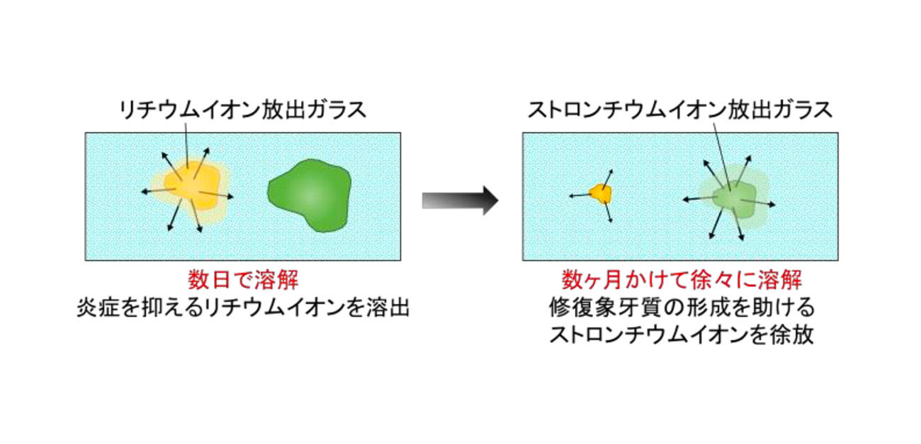 歯の神経を守る! イオンを段階的に放出するガラス粒子を開発
