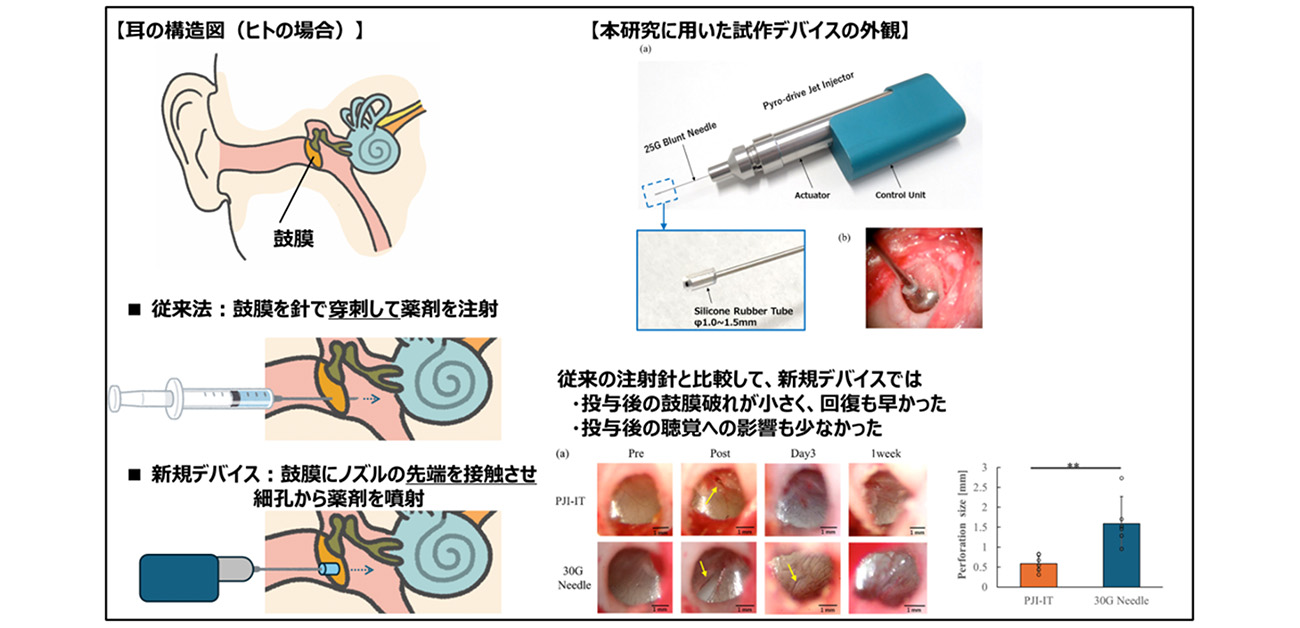 \針を使わず、mRNAを内耳へ/ 内耳疾患治療に向けた 低侵襲メッセンジャーRNA(mRNA) 送達技術を開発