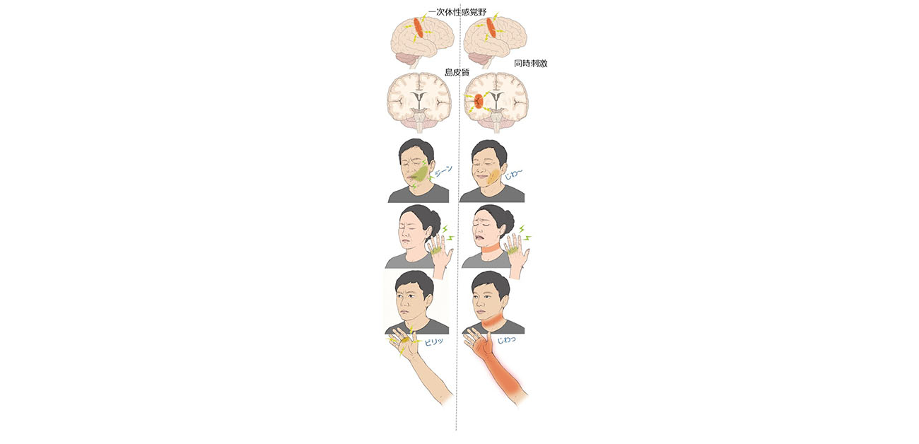 脳の多領域の同時刺激でより豊かな感覚が生じることを発見