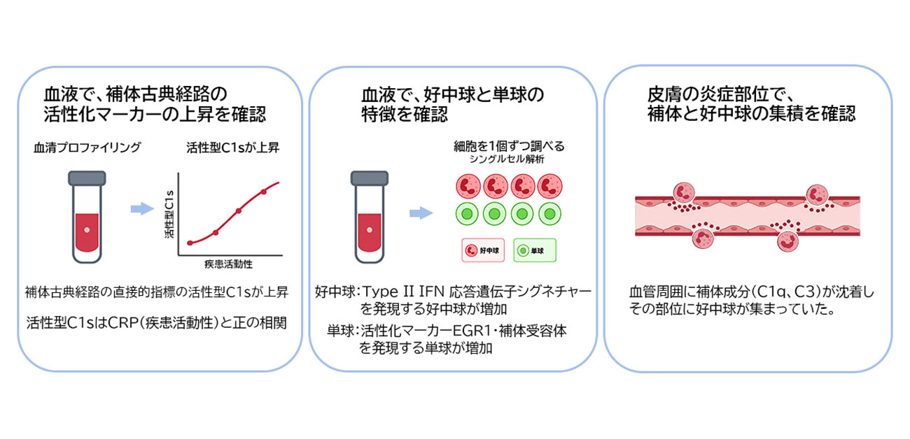 指定難病「ベーチェット病」における補体古典経路を介した炎症メカニズムの解明