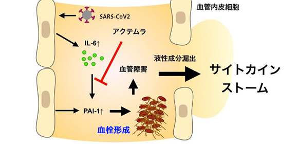 新型コロナウイルス感染性肺炎の重症化抑制の仕組みを解明